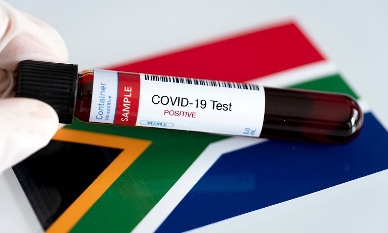 test tube of blood with Covid test positive written on the label